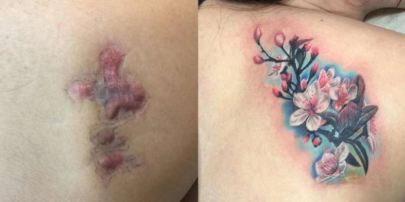 Hình xăm che sẹo lồi ở vai hoàn hảo bằng hoa anh đào