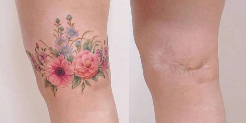 Hình xăm bông hoa che sẹo lồi ở chân
