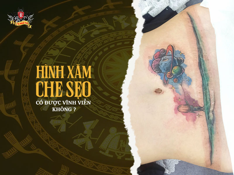 Độ bền của hình xăm che sẹo và các yếu tố làm mờ màu theo thời gian