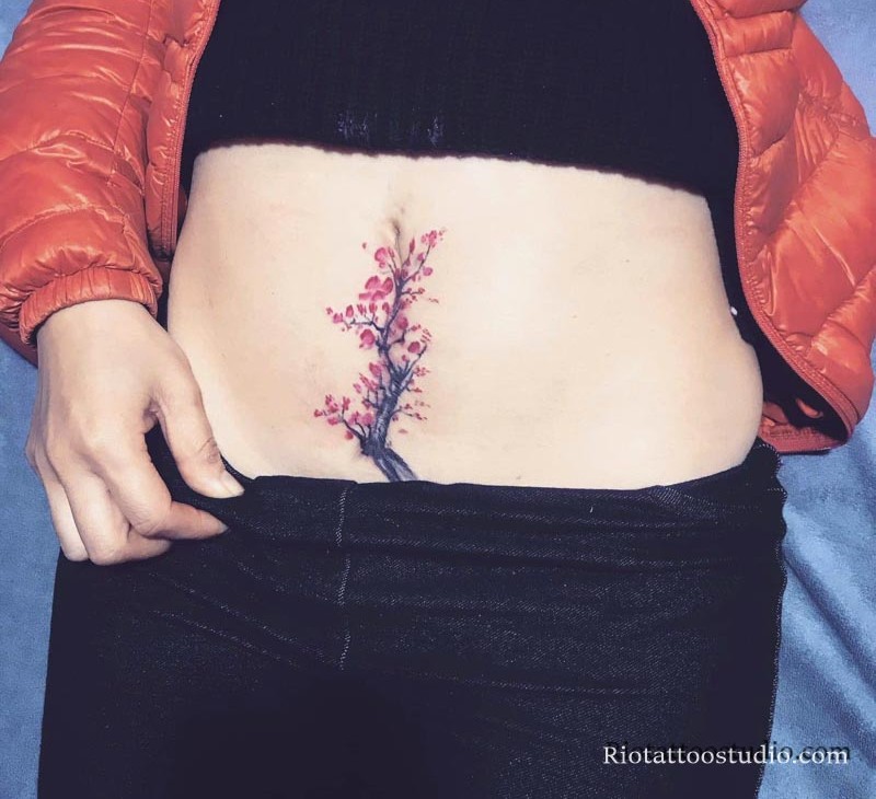 Hình xăm che sẹo mổ dọc ở bụng sau khi sinh