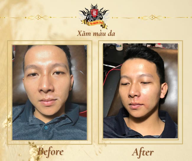  xăm màu da người là một kỹ thuật phun xăm thẩm mỹ chuyên biệt, sử dụng các sắc tố mực gần giống với màu da tự nhiên của bạn để che phủ hoặc làm mờ các vết sẹo, vùng da bị mất sắc tố, hay những khuyết điểm khác