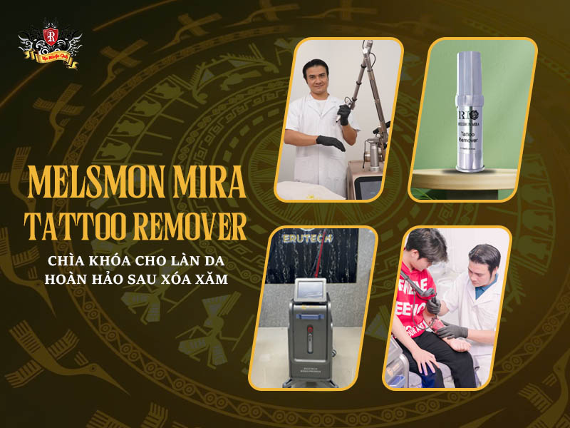 kem-duong-phuc-hoi-sau-xoa-xam-melsmon-mira-tattoo-remover