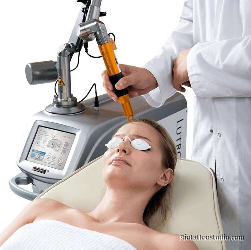 Đến từ Hàn Quốc, thủ phủ của ngành thẩm mỹ công nghệ cao, SPECTRA Nd:YAG là chuyên gia xử lý mực đen và đen trắng.