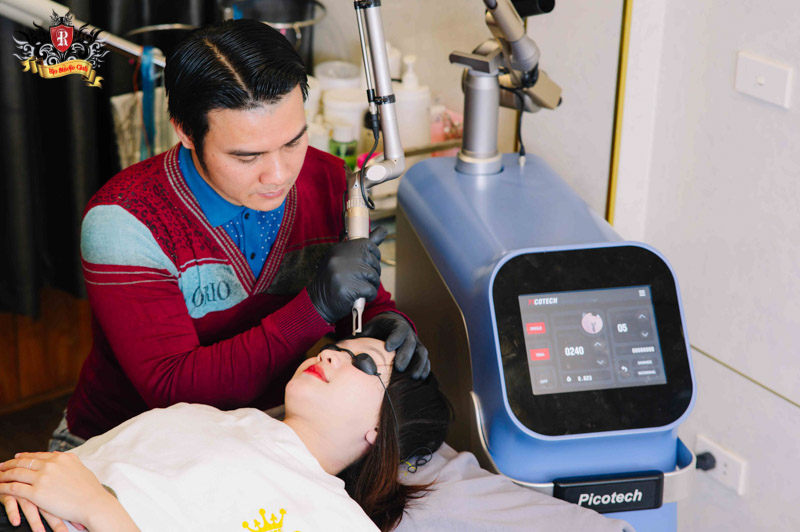 Tại Rio Tattoo Studio, chúng tôi đã tối ưu hóa công nghệ này không chỉ để xóa hình xăm mà còn phát huy tối đa khả năng khử thâm, làm sáng và đều màu da sau mỗi buổi xóa xăm. Làn da của bạn sẽ không còn dấu hiệu thâm sạm sau khi mực xăm biến mất.