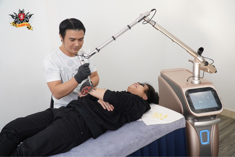 Ngoài ra tại Rio Tattoo Studio còn có dùng máy xóa xăm Ruby Laser Alpha6 nổi tiếng thế giới. với đầy đủ các tính năng an toàn y tế như ISO 13485 - FDA - CFDA - TUV - CE
