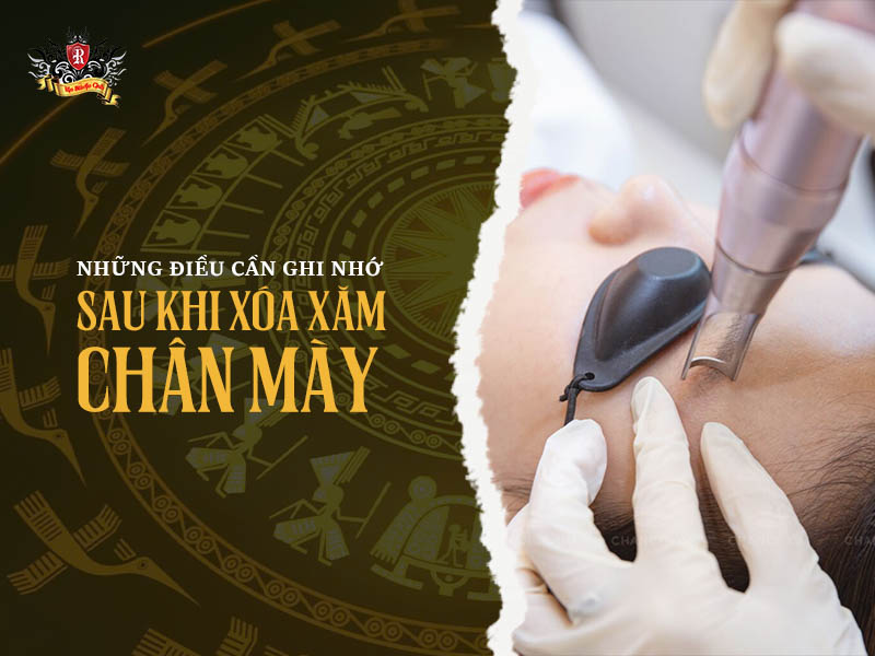 Những điều cần ghi nhớ sau khi xóa xăm chân mày