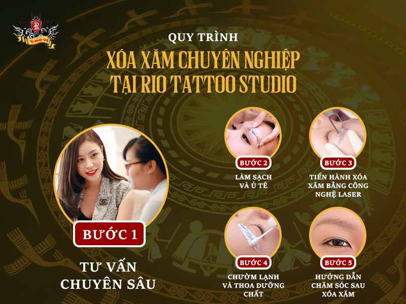 Quy trình xóa xăm chuyên nghiệp tại Rio Tattoo Studio
