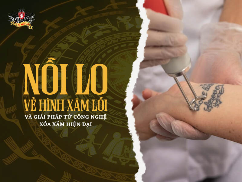 Nỗi lo về hình xăm lỗi và giải pháp từ công nghệ xoá xăm laser hiện đại 