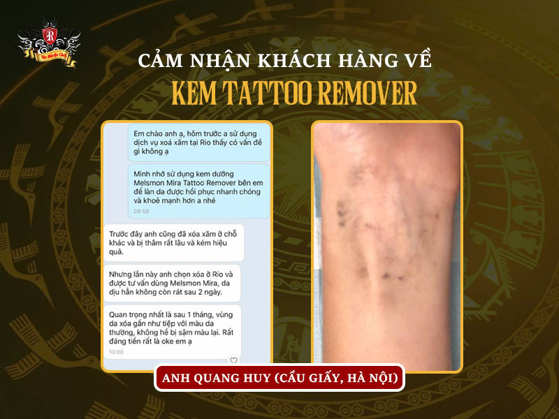 Review thực tế khách hàng dùng kem dưỡng sau xóa xăm Melsmon Mira Tattoo Remover tại Rio Tattoo Studio.