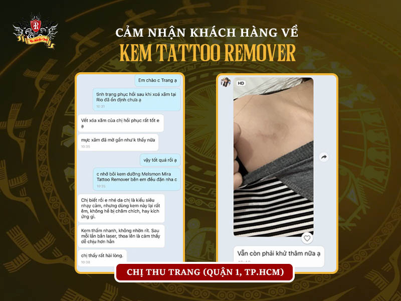 Chị Minh Anh xóa hình xăm ở ngực thành công nhờ dùng kem dưỡng sau xóa xăm Melsmon Mira Tattoo Remover.