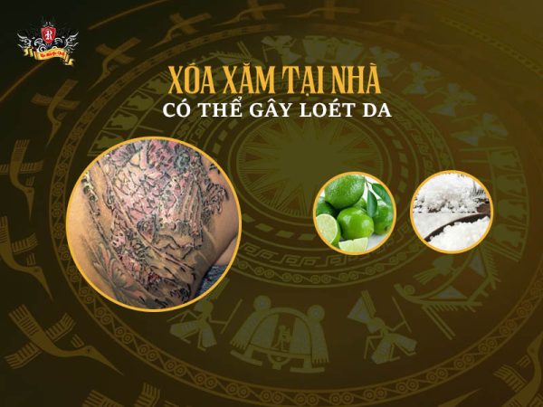 Hình xăm có xóa được không – Cảnh báo biến chứng loét da khi tự xóa xăm tại nhà bằng chanh và muối.