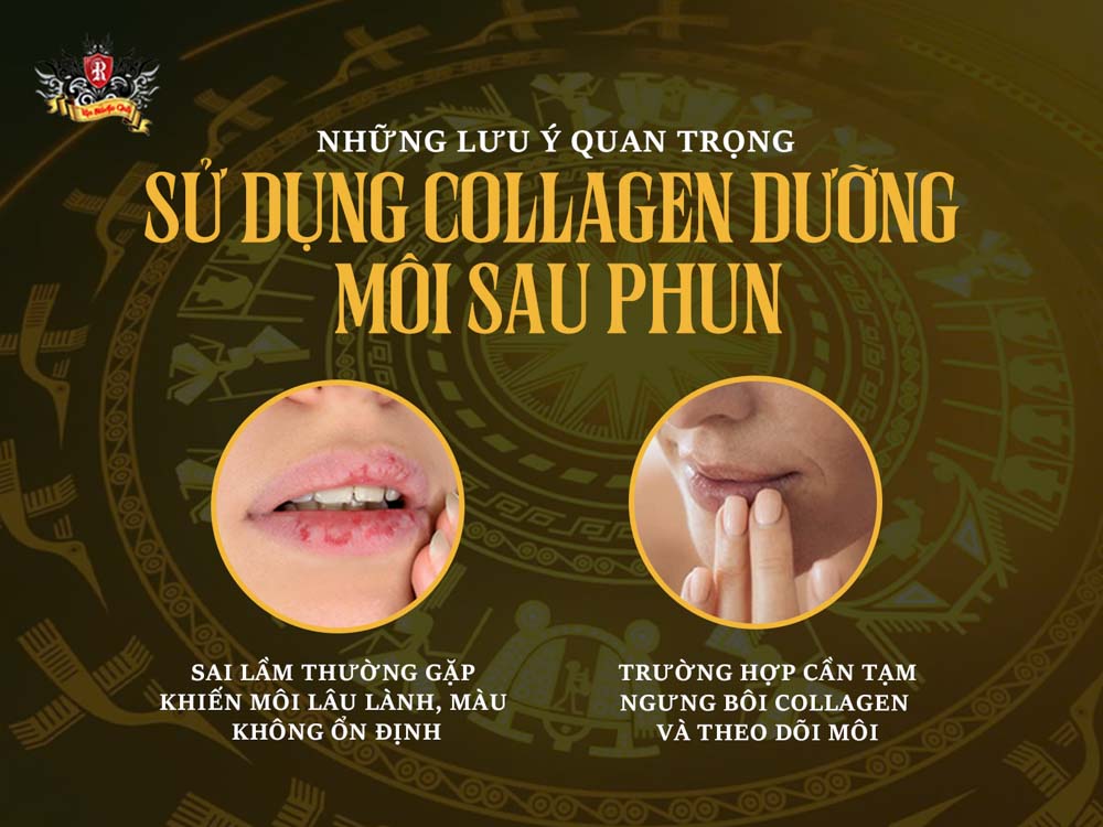 những lưu ý quan trọng khi sử dụng collagen dưỡng môi sau phun – collagen dưỡng môi sau xăm hiệu quả