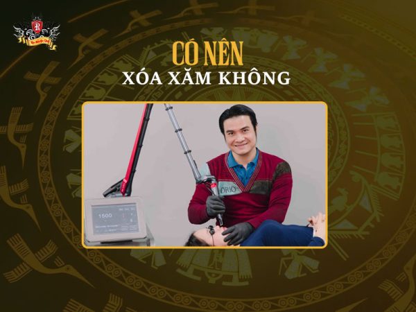 Hình xăm có xóa được không – giải đáp các câu hỏi thường gặp về xóa xăm an toàn bằng laser