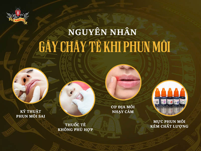 nguyên nhân gây phun môi bị cháy tê – môi đau rát sau phun