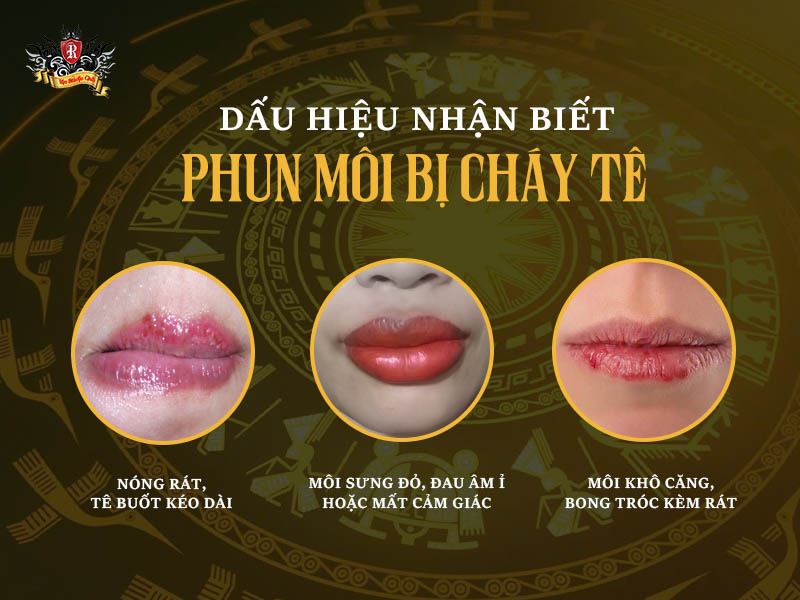 dấu hiệu nhận biết phun môi bị cháy tê – môi đau rát, tê cứng sau phun