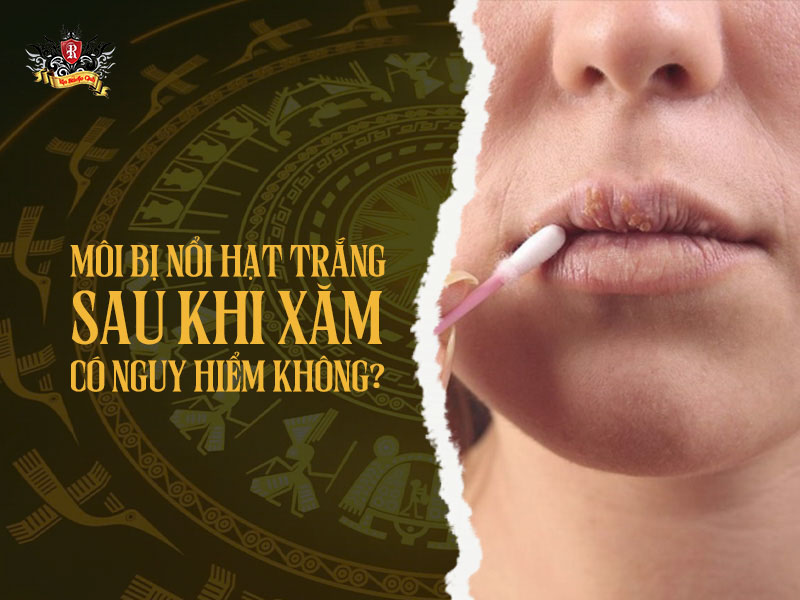 Phun môi bị nổi mụn trắng – có nguy hiểm không sau khi xăm