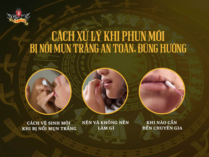 Phun môi bị nổi mụn trắng – cách xử lý an toàn, đúng hướng