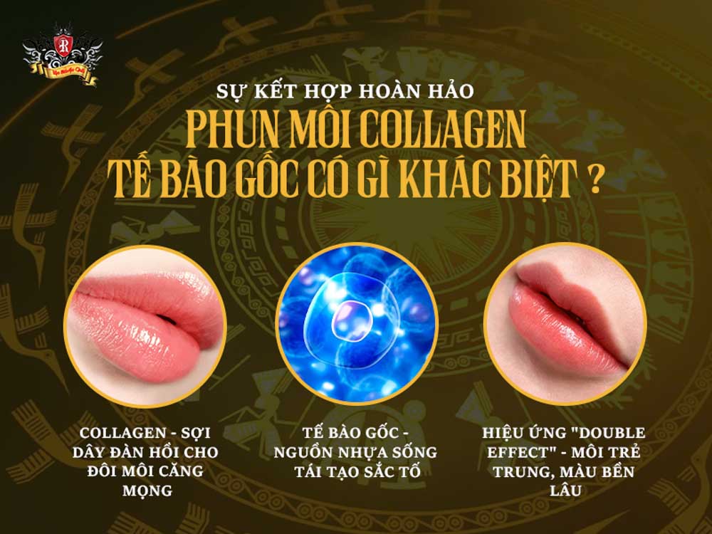 phun môi tế bào gốc kết hợp collagen – môi mềm mịn, lên màu chuẩn và đều màu
