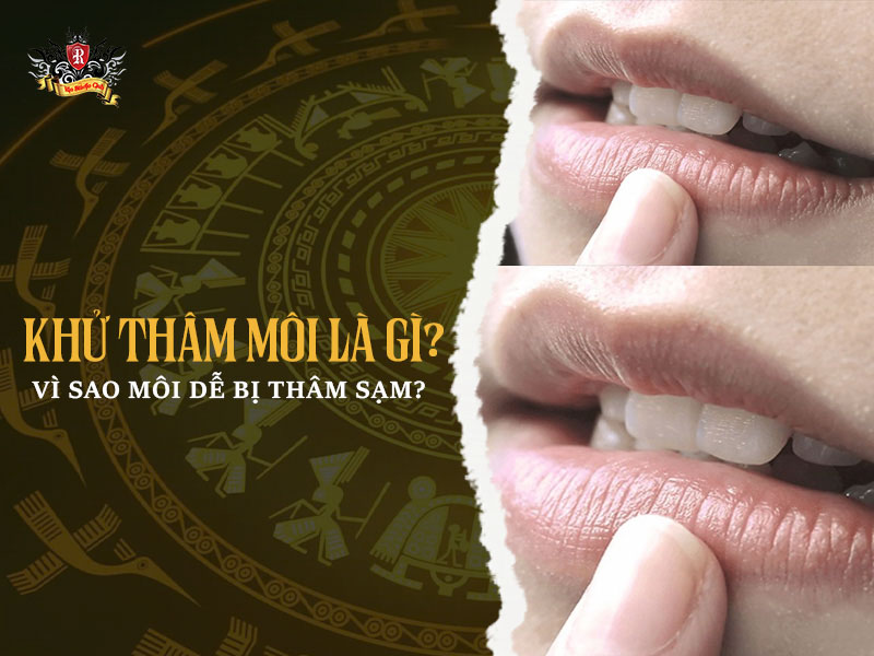 Khử thâm môi là gì – quy trình khử thâm môi an toàn, hiệu quả