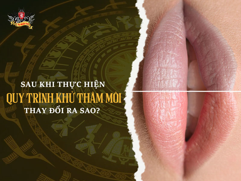 Quy trình khử thâm môi – thay đổi môi sau khi thực hiện