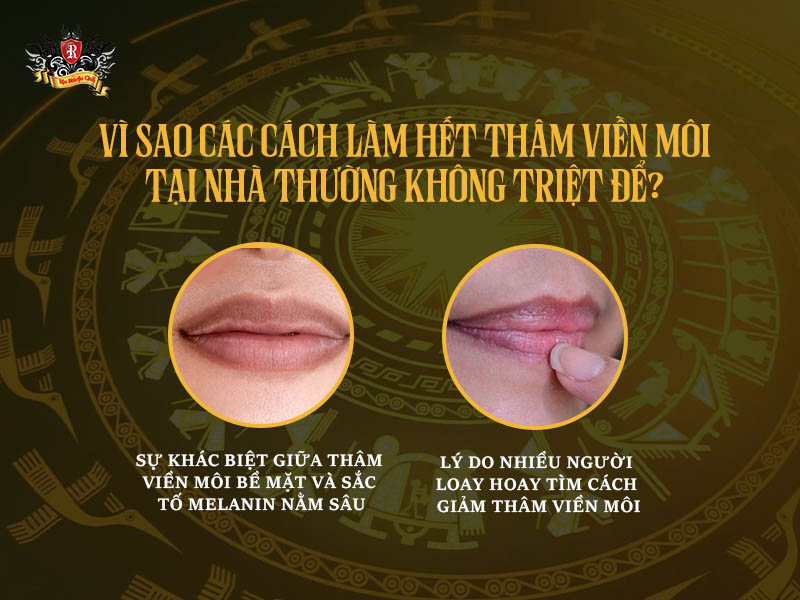 vì sao các cách làm hết thâm viền môi tại nhà thường không triệt để