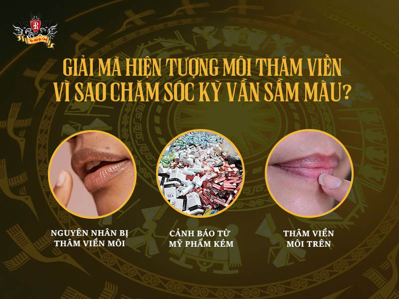 giải mã hiện tượng thâm viền môi – nguyên nhân môi sẫm màu dù chăm sóc kỹ