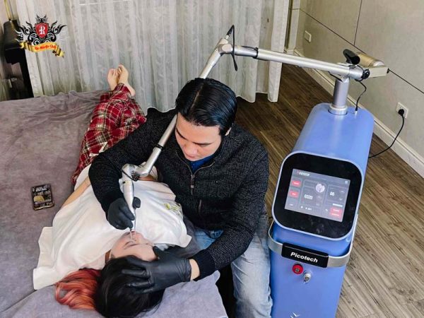 Xóa xăm lông mày bằng laser công nghệ cao an toàn và hiệu quả tại Rio Tattoo Studio