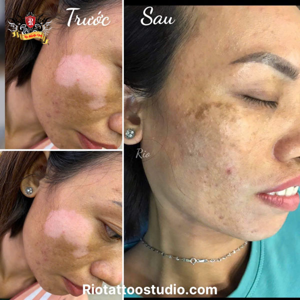 Master Artist Trieu Viet Anh: International WULOP Judge 2 - Rio Tattoo Studio