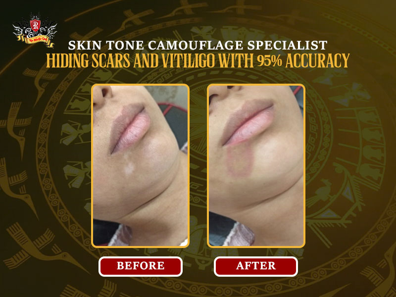 Artist-Trieu-Viet-Anh-vitiligo-camouflage-tattoo-95-percent-coverage-undetectable