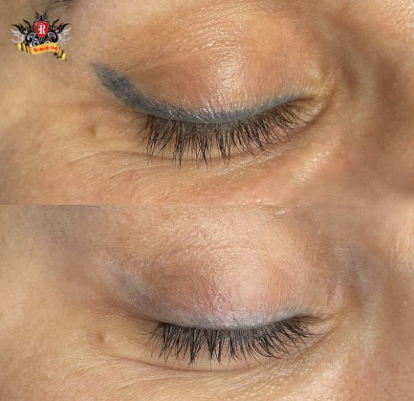 Khách hàng nước ngoài xóa xăm lông mày sạch hoàn toàn sau 3 lần tại Rio Tattoo Studio.