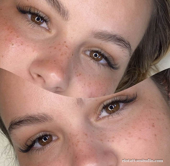 Artistic freckles and tattoos resembling natural pollen dancing in the wind, capturing a poetic and whimsical beauty at Rio Tattoo Studio.