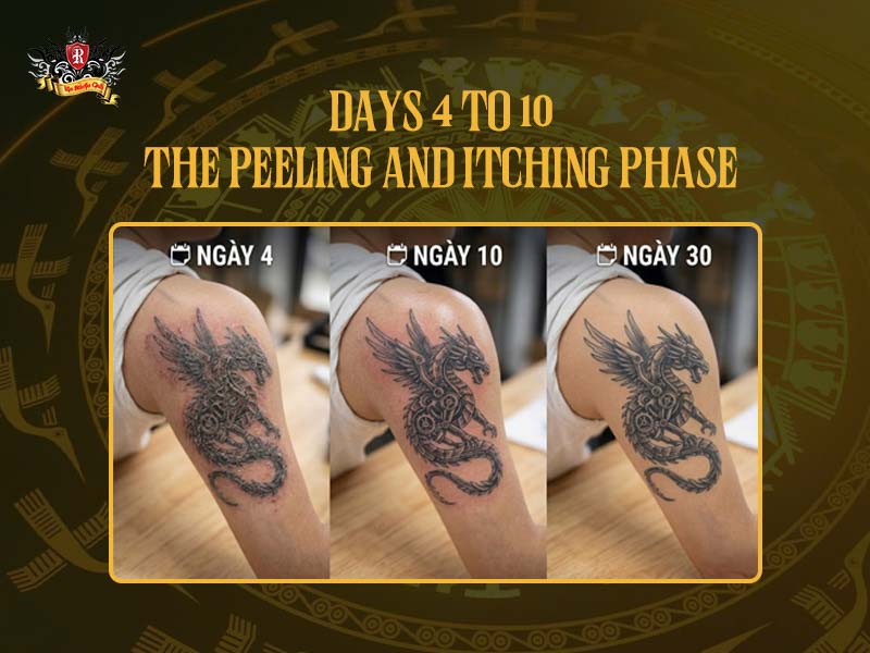 Close-up of a tattoo in the peeling stage requiring proper Tattoo Aftercare.