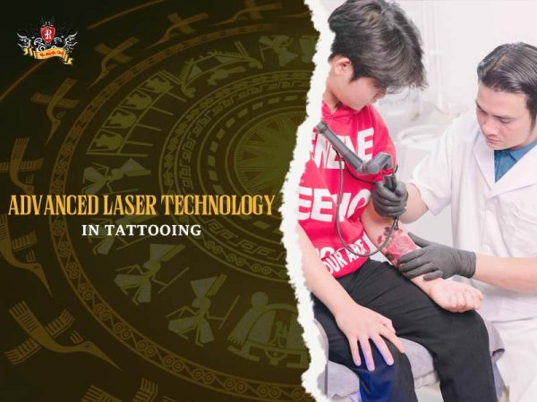 Professional laser tattoo removal session at Rio Tattoo Studio using advanced laser technology to prepare for coverups tattoo