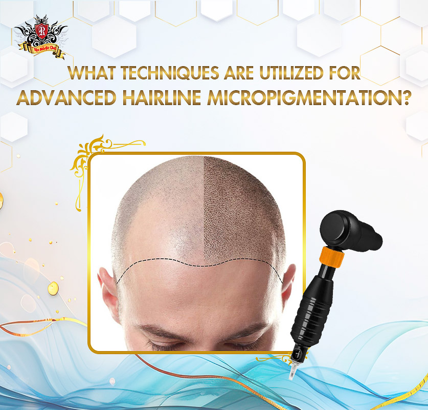 Micro-dotting hair follicle replication technique for advanced Tattoo Hairline results.